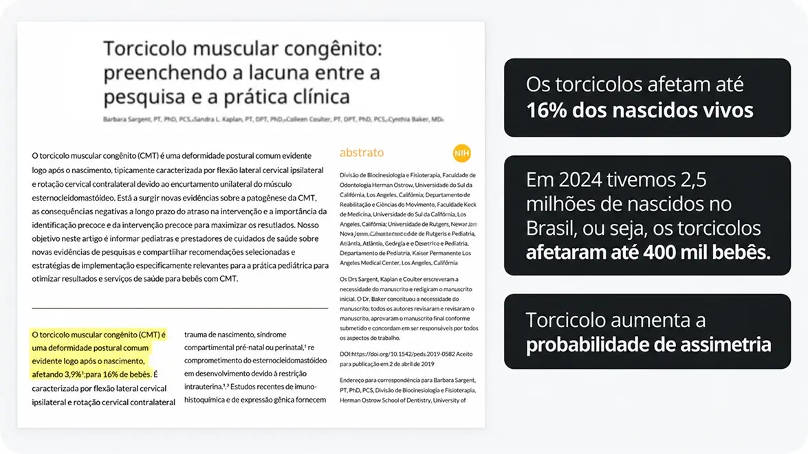 Torcicolos congênitos afetam 16% dos nascidos vivos, somando cerca de 2,5 milhões de bebês em 2024